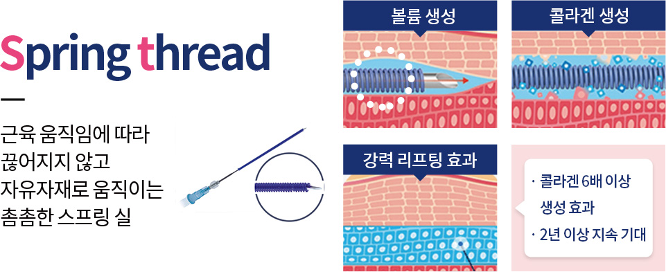 근육 움직임에 따라 끊어지지 않고 자유자재로 움직이는 촘촘한 스프링 실 송파캐번리프팅,문정캐번리프팅